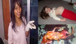 Xôn xao những vụ thai phụ mang bầu đẻ ra động vật 