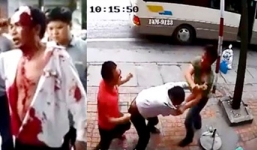 Vụ nhà xe đánh hành khách bị thương: Công an vào cuộc điều tra