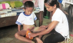 Bé trai nhầm giới tính vì không có hậu môn, bộ phận sinh dục