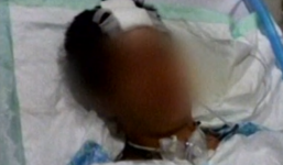 'Lĩnh đạn' vào đầu vì chụp ảnh 'tự sướng' với súng