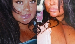 Chi 4 tỷ làm phẫu thuật thẩm mỹ để 'xấu' như người tiền sử