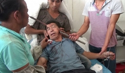 Thoát chết ngoạn mục sau khi bị thanh sắt đâm xuyên đầu