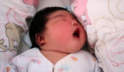 Ca sinh thường bé sơ sinh khổng lồ nặng 6,3kg 