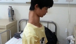 Chàng trai có chiếc cổ mọc dài lạ thường