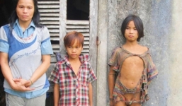 Xót thương chuyện 'người rừng' ăn cá sống, trèo cây như Tazan