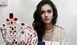 Hoa hậu châu Á Thái Bình Dương lộ ảnh phẫu thuật