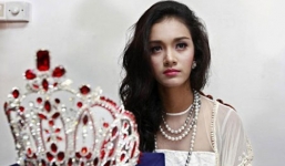 Hoa hậu châu Á Thái Bình Dương bị tước vương niệm vì lộ ảnh phẫu thuật?