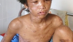 Vẫn còn những tấm lòng thương cảm cho Hào Anh