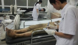 Tai nạn ở Sa Pa: 20 bệnh nhân được ra viện, 2 trường hợp diễn biến xấu