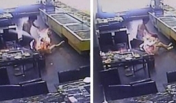 Đi ăn đồ nướng, cô gái bị lửa bén cháy như đuốc sống