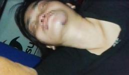 Bảo vệ khu phố ở Sài Gòn dùng dây siết cổ, đạp vợ ngất xỉu