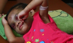 'Địa ngục' trần gian của bé Kim Ngân