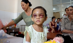Vụ bé gái 4 tuổi bị đánh dã man: Người tự nhận là bà ngoại giữ tiền, giành quyền nuôi Ngân