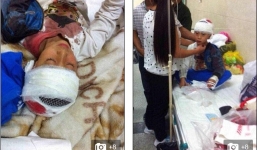 Trung Quốc: Giáo viên nghệ thuật dùng sách đánh vỡ sọ học sinh