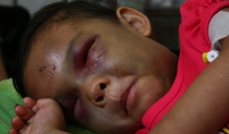 Vụ bé gái 4 tuổi bị đánh: Minh không phải là cha ruột của bé Ngân?