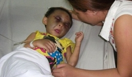 Những đứa trẻ bị cha mẹ bạo hành dã man như thời trung cổ