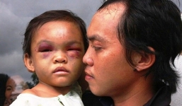 Xuất hiện tình tiết bất ngờ vụ bé gái 4 tuổi bị đánh dã man