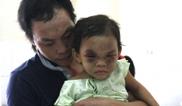 Những câu nói nhói lòng của bé 4 tuổi với người mẹ đánh con biến dạng mặt