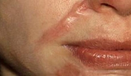 Nghi ngờ chồng 'léng phéng' chở con 14 tuổi đi rạch mặt tình địch