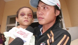 Vụ bé gái 4 tuổi bị đánh đập dã man: Giám định ADN để xác định cha đẻ