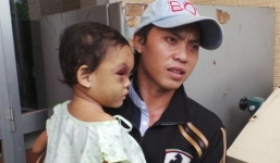 Ai sẽ được nuôi bé Ngân khi người mẹ đánh con biến dạng mặt lĩnh án?