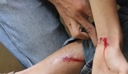 Côn đồ đánh 4 phóng viên và dọa đến nhà truy sát