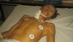 Con tâm thần cắt cổ cha già giữa đêm khuya