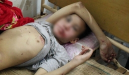 Dấu hiệu bất thường của kẻ đánh đập dã man bé trai tại khách sạn