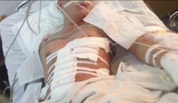 Suýt mất mạng vì bị truy sát… vô cớ khi đang ngồi nhậu