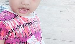 Trẻ mầm non nhập viện sau khi bị giáo viên đánh