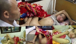 Đã bắt giữ nghi can hành hạ bé trai 14 tuổi trong khách sạn