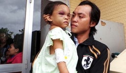 Xét nghiệm AND để xác định cha ruột bé Ngân bị bạo hành