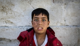 Thảm cảnh của người dân Syria dưới làn đạn