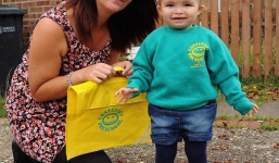 Bé gái 2 tuổi, u nang hai bộ phận vẫn sống khỏe mạnh