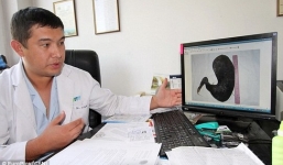 Phẫu thuật lấy bó tóc 4 kg trong bụng bệnh nhân