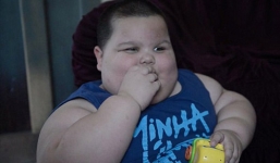 Mắc bệnh không thể dừng ăn bé 3 tuổi nặng 70kg