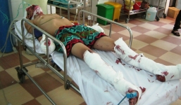 Bé trai đã gửi chiếc loa nổ tung trên xe giường nằm