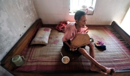 Nỗi khổ của cụ bà 97 tuổi mọc sừng 20 cm ở chân