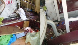 Tài xế kể lại vụ nổ trên xe giường nằm