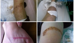 Côn đồ bịt mặt trút mưa dao xuống cả gia đình ngay trước bữa ăn