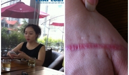 Được thuê 20 triệu, côn đồ xuống tay với cả phụ nữ mang bầu