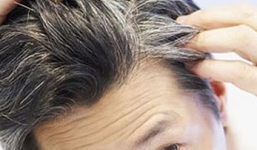 Vì sao tóc con người lại bạc đi?