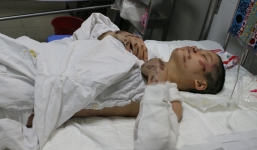 Thai phụ bị ôtô kéo lê có thể bị hoại tử hai chân