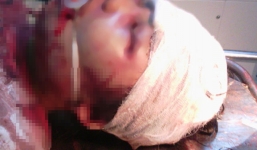 Bé gái 14 tuổi bị đánh vô cùng dã man trong đêm