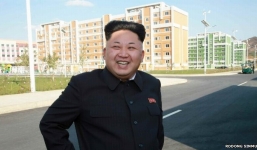 Kim Jong-un đã được bác sĩ Pháp phẫu thuật mắt cá chân