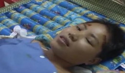 Cầm dao đuổi chém em vợ nhiều nhát gây thương tích nặng