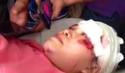 Hai mẹ con thoát chết trong vụ nổ lớn tại TP.HCM 