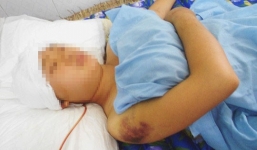 Trưởng phòng y tế bị thanh niên bịt mặt hành hung