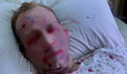 Họp báo Bộ Y tế: Thông tin mới nhất về dịch Ebola