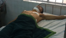 Đến công an đầu thú sau khi dùng dao sát hại vợ rồi tự tử không thành